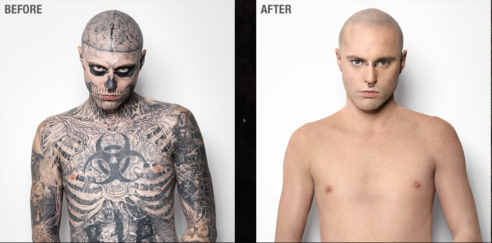 Tatuagens antes e depois 